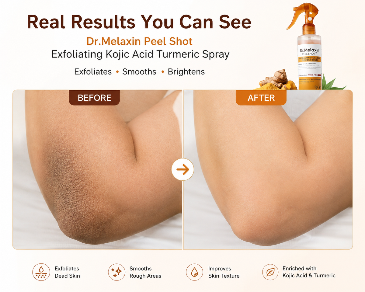 Dr.Melaxin Peel Shot Kojic Acid Turmeric Exfoliating Spray – 200ml